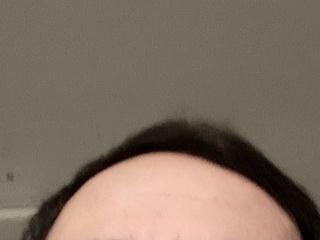 AlbertinXSmile