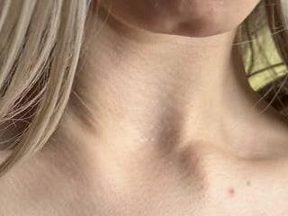 checkmypeach1