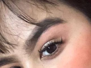 EylinFox 