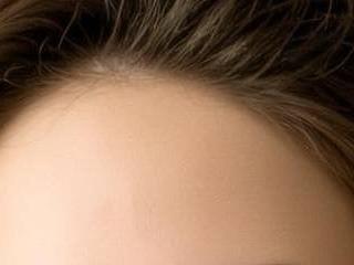 Flora Tease
