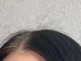 Kedityn
